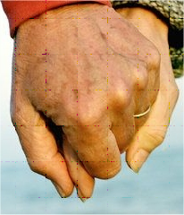 Manos